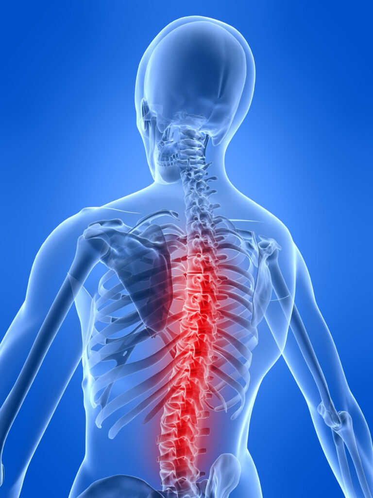 Benefits of Chiropractic Care