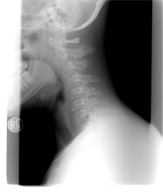 Your Spine Pt. 1 of 3 — The Cervical Spine