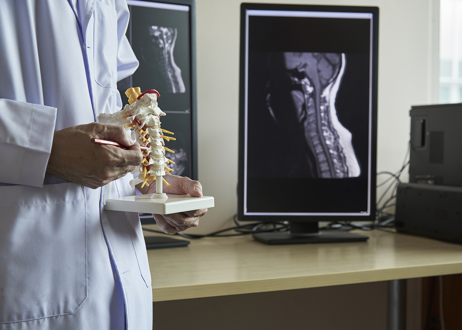 Doctor in white coat holding spine model with MRI images displayed on monitors in background